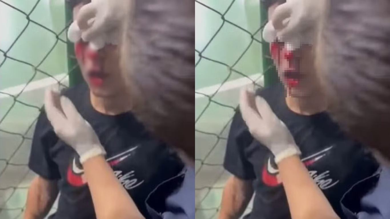 Bomba explode no vestiário de partida de futsal e deixa jogador gravemente ferido 1 bomba explode no vestiario de partida de futsal e deixa jogador gravemente ferido