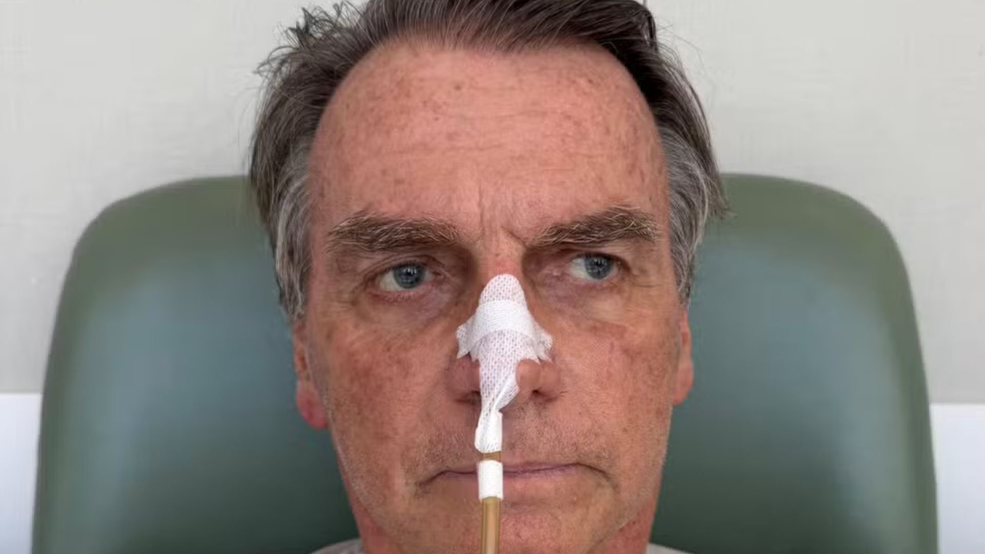 Exames indicam evolução no quadro clínico de Jair Bolsonaro 1 exames indicam evolucao no quadro clinico de jair bolsonaro