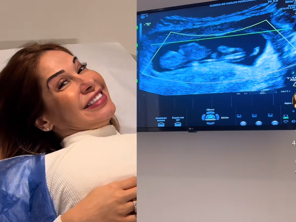 Maíra Cardi revela que terá dois médicos e mostra 1ª ultra do filho com Nigro 1 maira cardi revela que tera dois medicos e mostra 1 ultra do filho com nigro