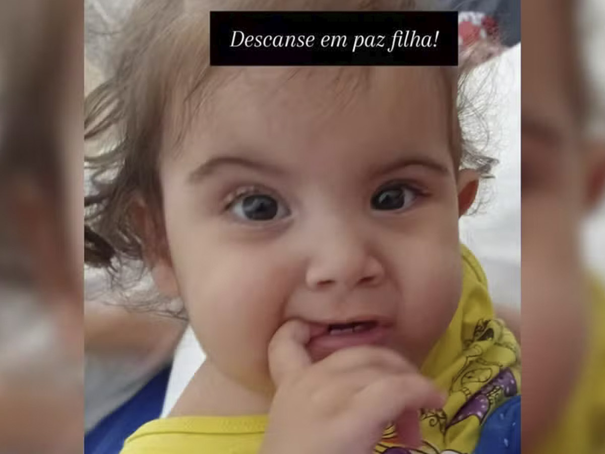 Bebê siamesa morre após cirurgia de separação; irmã segue em estado grave 1 bebe siamesa morre apos cirurgia de separacao irma segue em estado grave