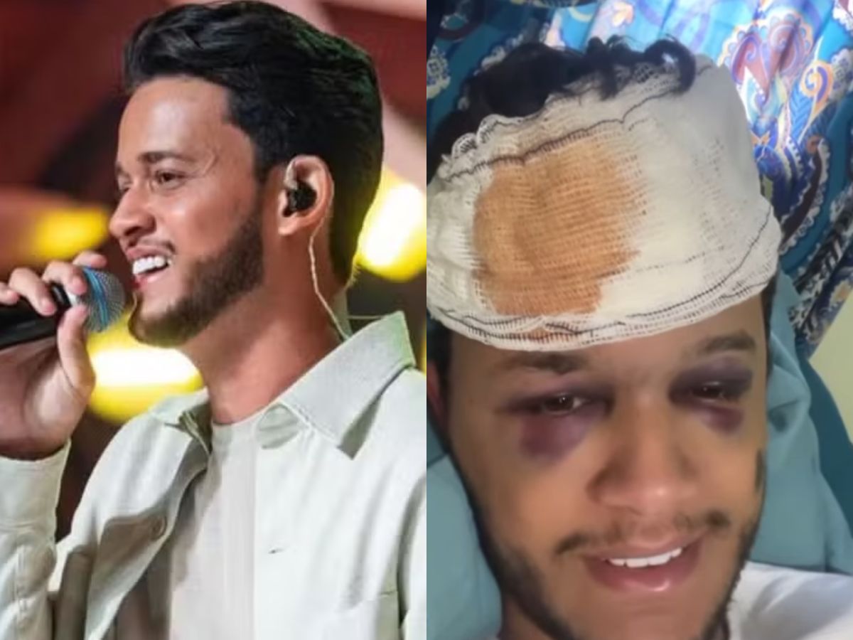 Cantor Hugo Sofre Traumatismo em Acidente de Carro 1 cantor hugo sofre traumatismo em acidente de carro