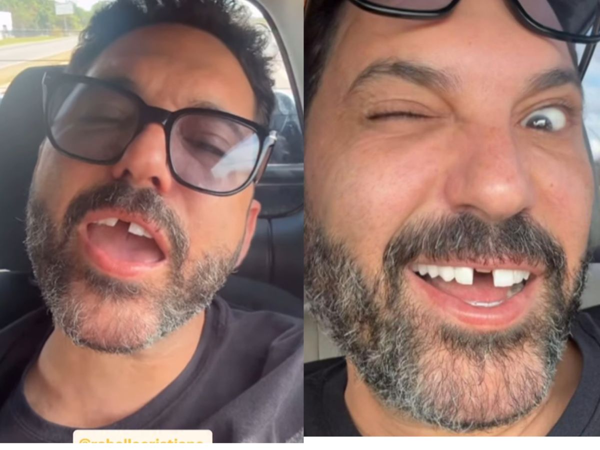 Edson perde dente antes de show e Hudson faz piada 1 edson perde dente antes de show e hudson faz piada