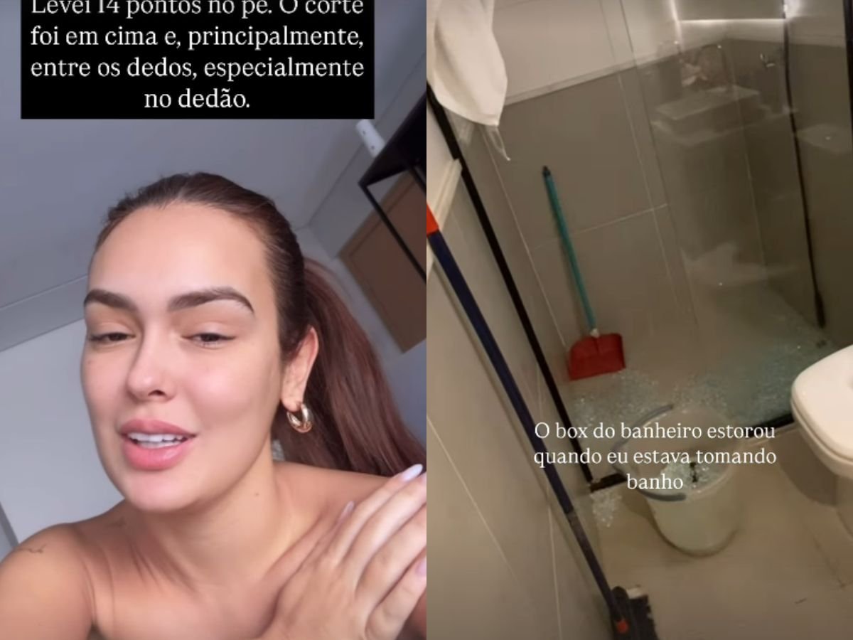 Ex-BBB Larissa Santos sofre acidente e leva 14 pontos no pé 1 exbbb larissa santos sofre acidente e leva 14 pontos no pe
