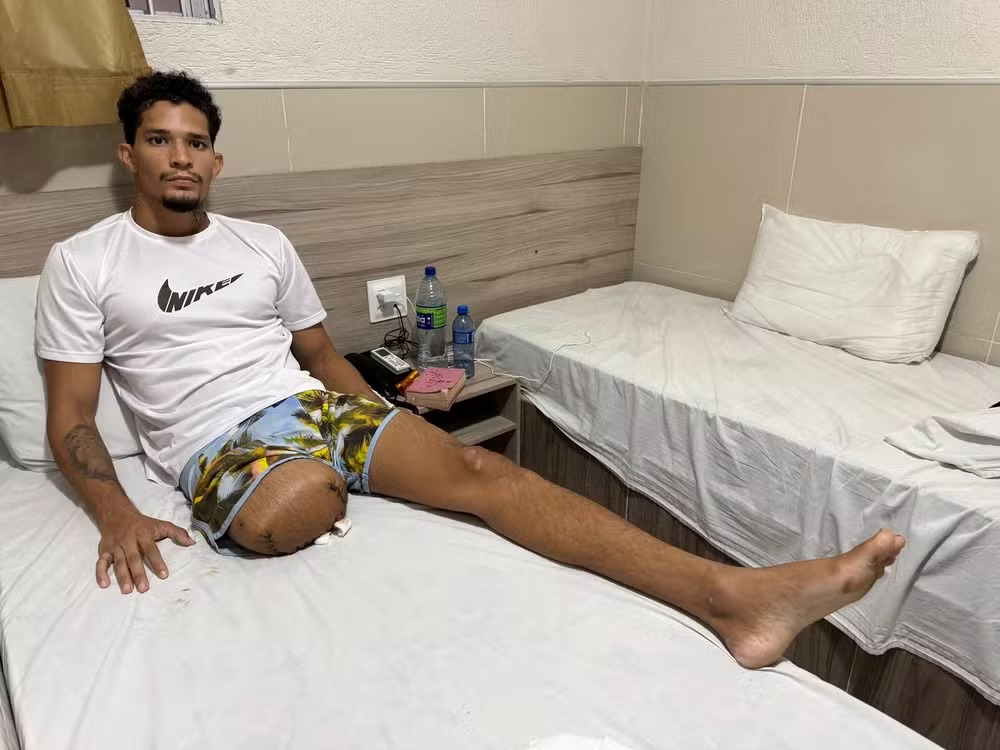 Jovem baleado em Noronha luta pela vida e amputação 1 jovem baleado em noronha luta pela vida e amputacao