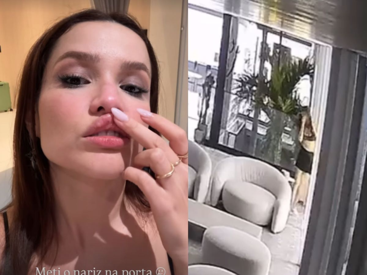 Juliette dá de cara em vidro e mostra como ficou seu rosto 1 juliette da de cara em vidro e mostra como ficou seu rosto