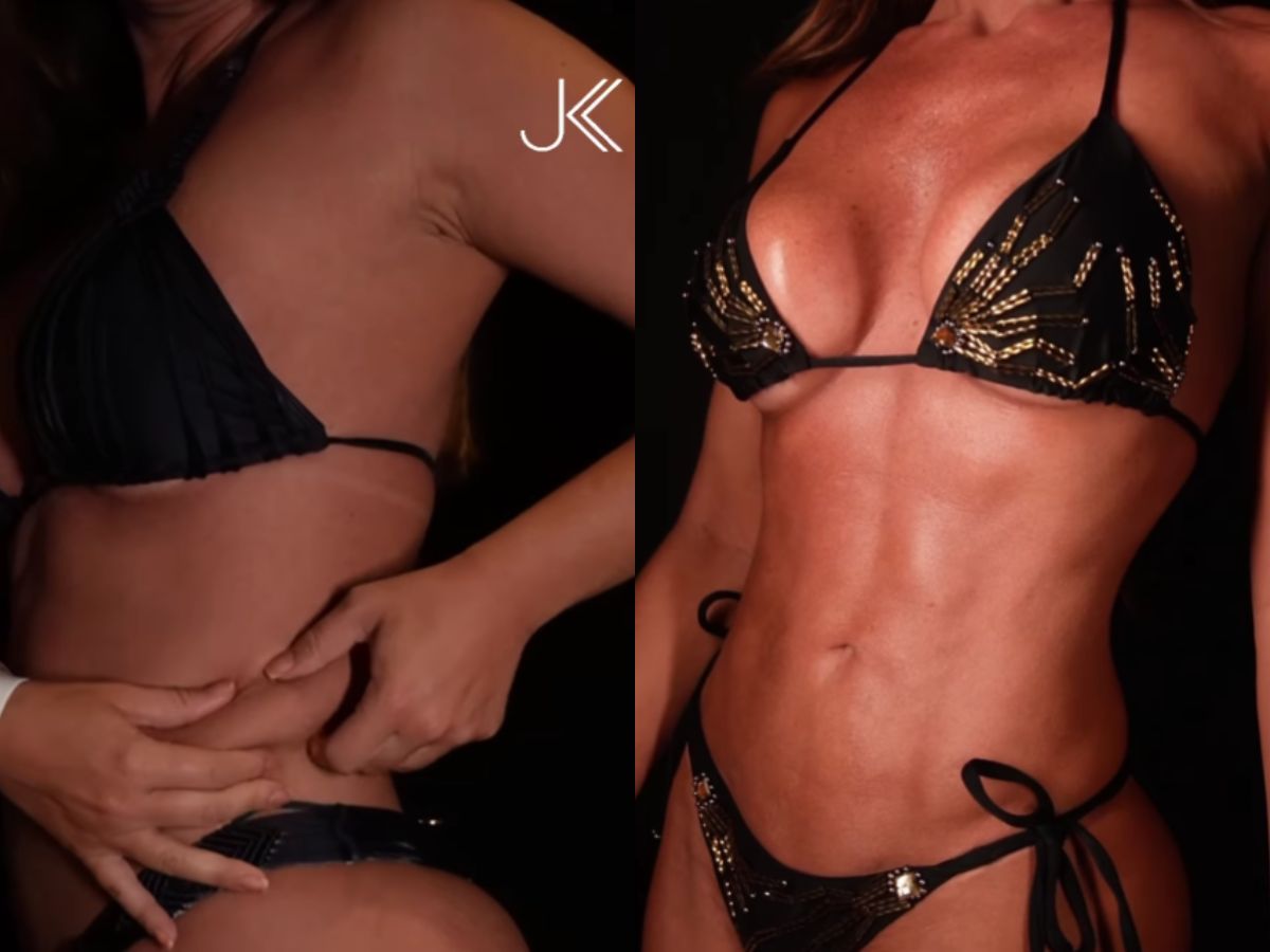 Nicole Bahls exibe resultado de Lipo HD e surpreende seguidores 1 nicole bahls exibe resultado de lipo hd e surpreende seguidores