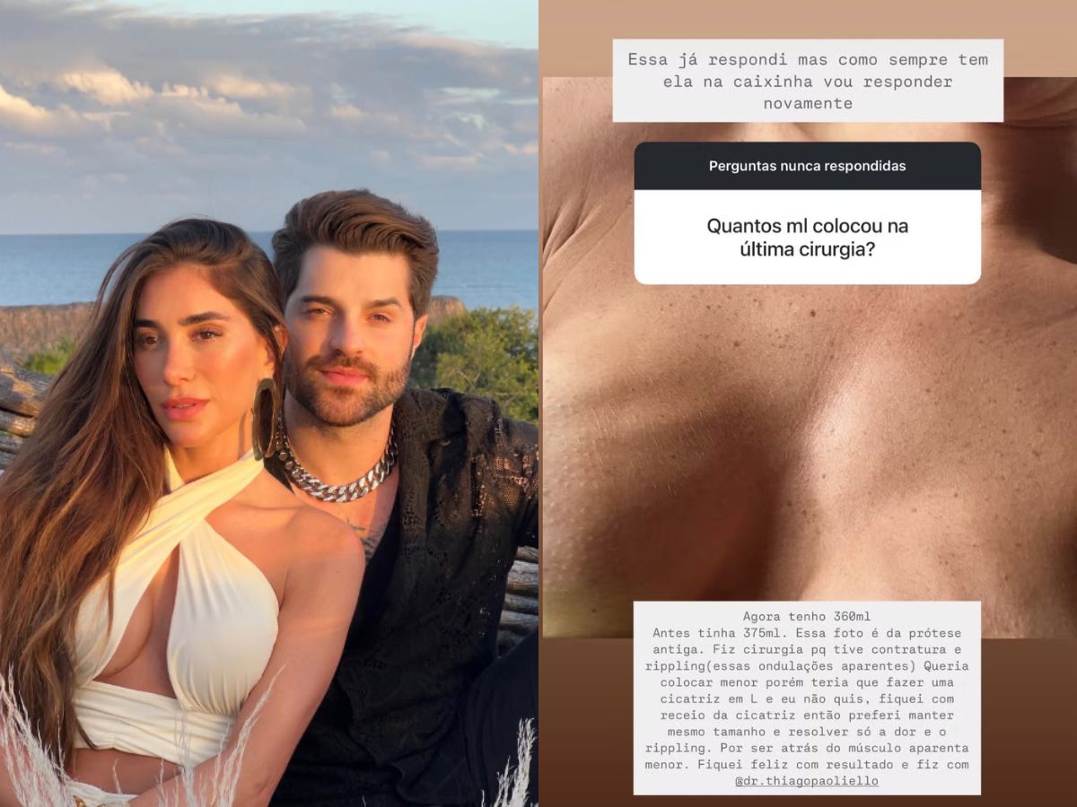 Romana Novais revela ondulações nos seios após complicações com silicone 1 romana novais revela ondulacoes nos seios apos complicacoes com silicone