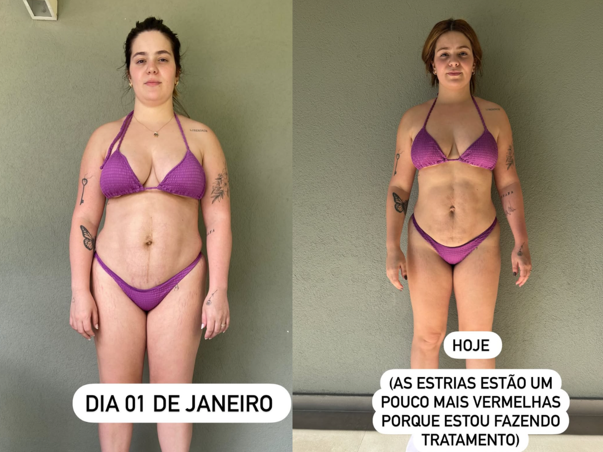 Viih Tube Mostra Corpo Após Perder 15kg: Invejosos Dirão que Estou Usando Mounjaro 1 viih tube mostra corpo apos perder 15kg invejosos dirao que estou usando mounjaro