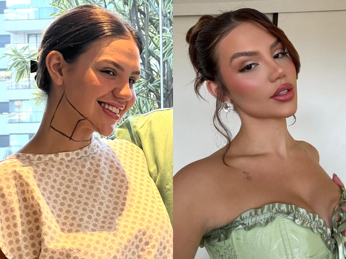 Vivi Wanderley Passa por Nova Cirurgia e Opera os Seios 1 vivi wanderley passa por nova cirurgia e opera os seios