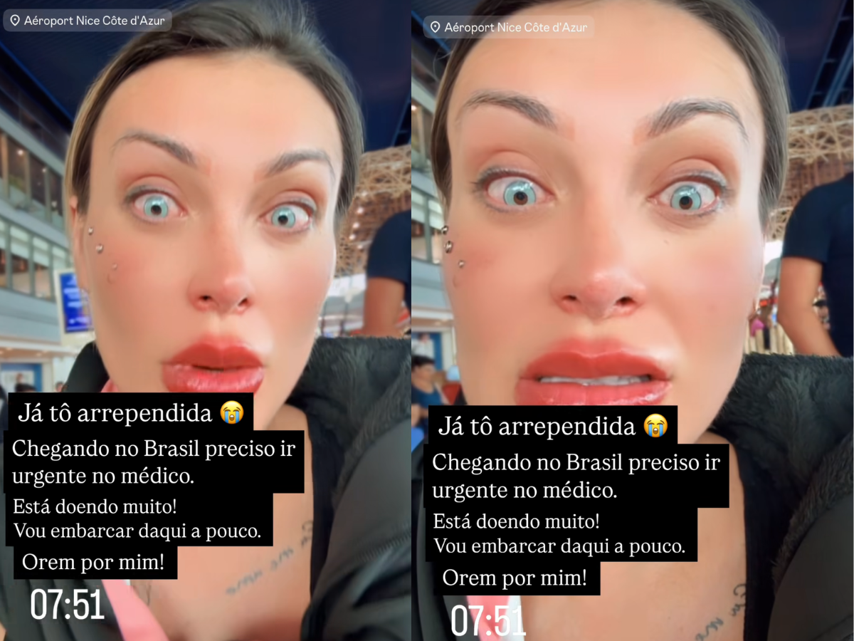 Andressa Urach revela complicação após mudança na cor dos olhos 1 andressa urach revela complicacao apos mudanca na cor dos olhos