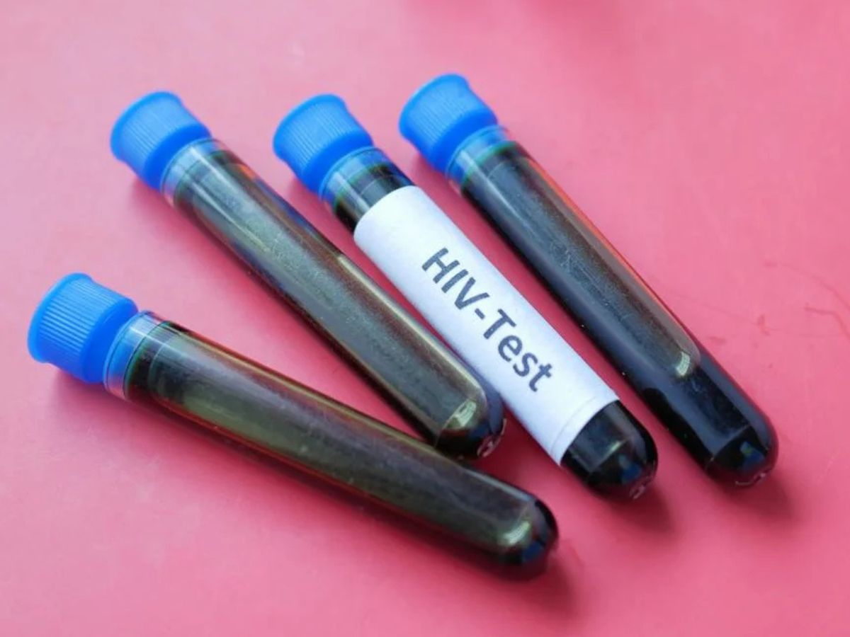Avanço considerado impossível na busca pela cura do HIV 1 avanco considerado impossivel na busca pela cura do hiv