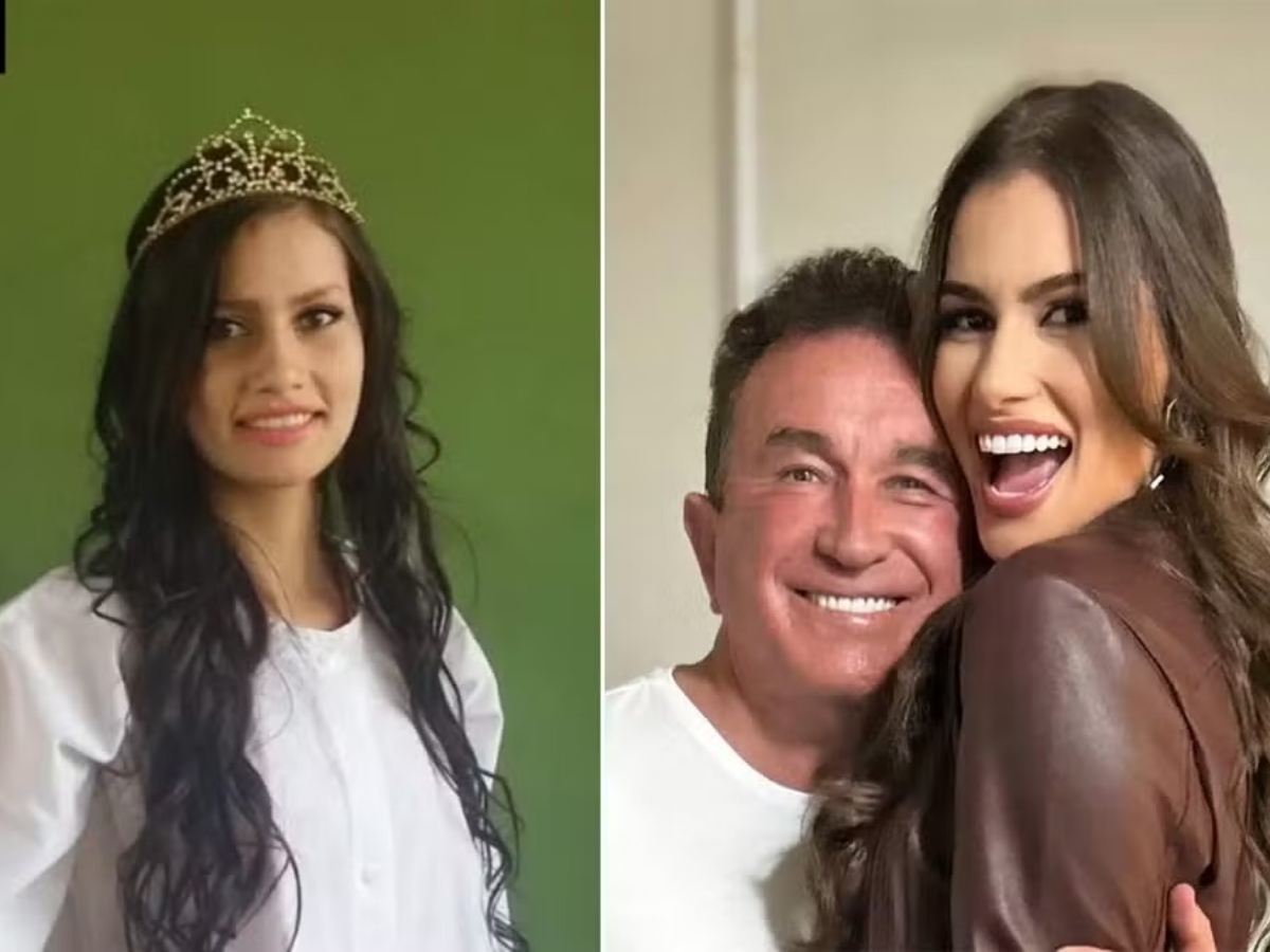 Calita Franciele fala sobre plásticas após fotos antigas 1 calita franciele fala sobre plasticas apos fotos antigas