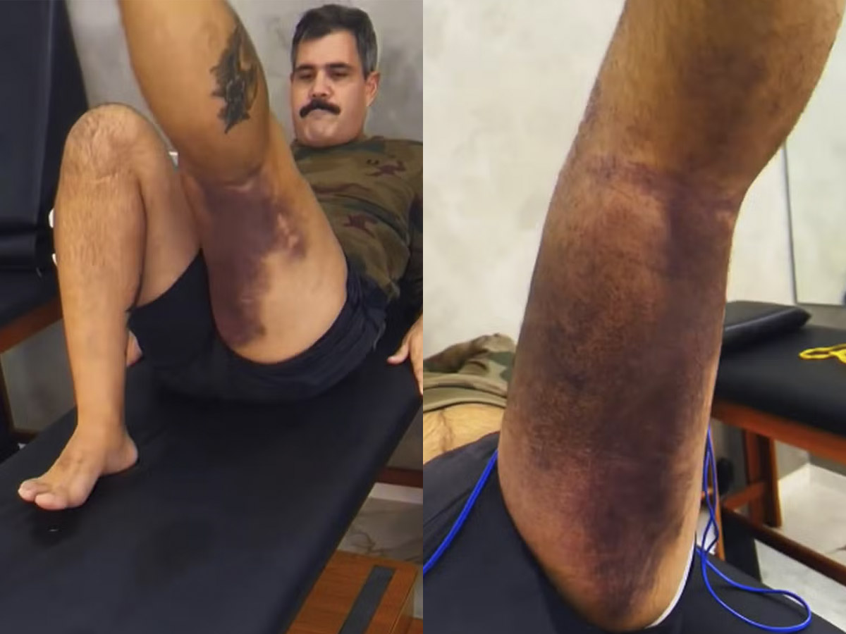 Juliano Cazarré inicia reabilitação após cirurgia no joelho 1 juliano cazarre inicia reabilitacao apos cirurgia no joelho