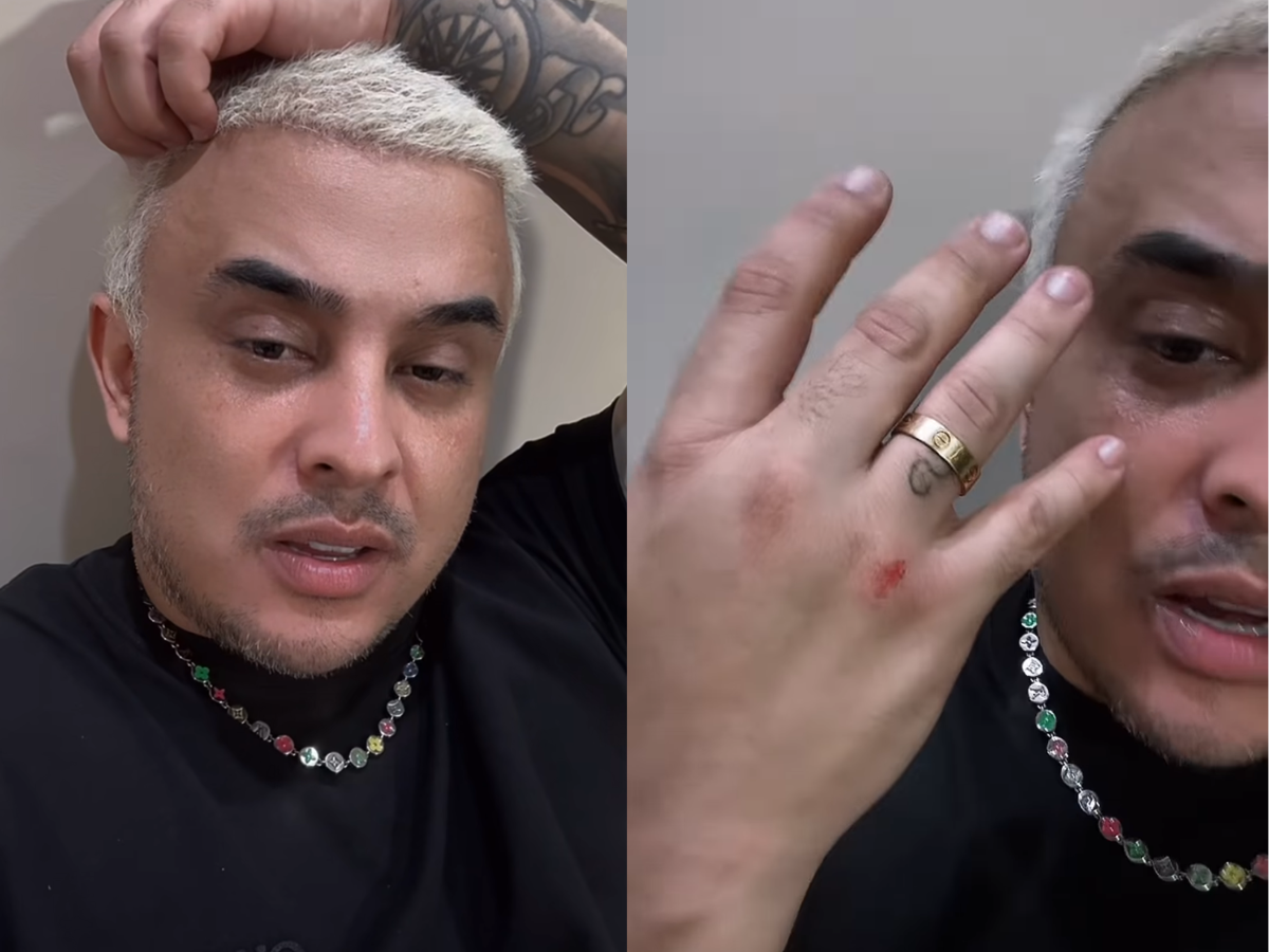 Kauan Mostra Ferimentos Após Cair Durante Show e Confessa: Fiquei com Vergonha 1 kauan mostra ferimentos apos cair durante show e confessa fiquei com vergonha
