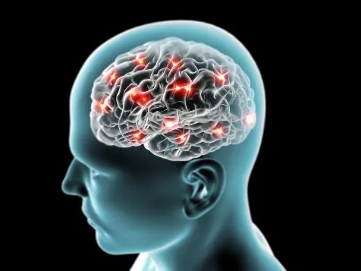 Morte Cerebral: Especialista Explica o Que Está Associado e Se Tem Como Evitar 1 morte cerebral especialista explica o que esta associado e se tem como evitar