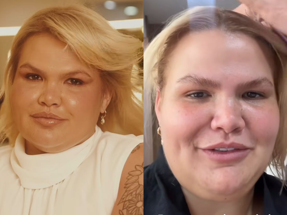 Thais Carla relata queda de cabelo após bariátrica 1 thais carla relata queda de cabelo apos bariatrica