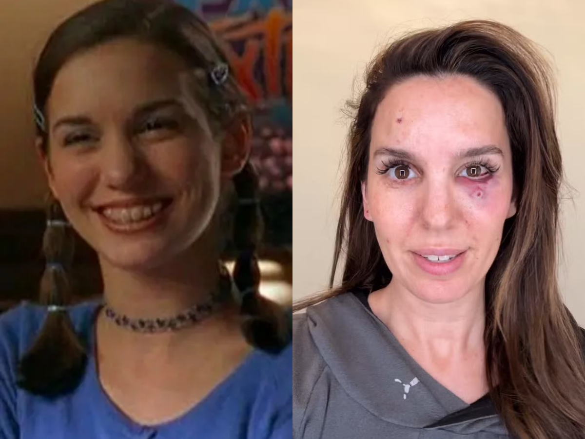Tiro no rosto: Christy Carlson Romano relembra trauma 1 tiro no rosto christy carlson romano relembra trauma