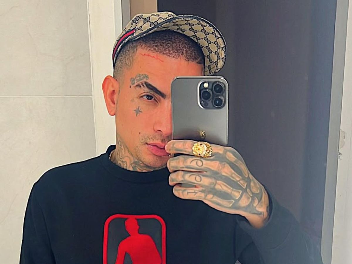 Um Novo Homem! MC Guimê Faz Harmonização Facial pela 1ª Vez e Exibe Resultado 1 um novo homem mc guime faz harmonizacao facial pela 1 vez e exibe resultado