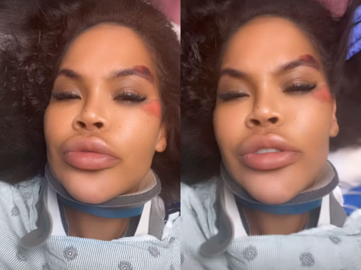 Ex-Big Brother desabafa sobre acidente e falta de socorro 1 exbig brother desabafa sobre acidente e falta de socorro