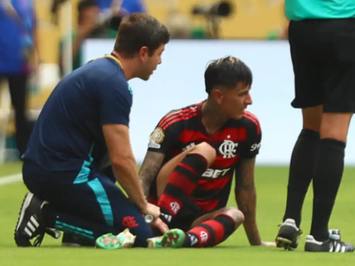 Fratura Reincidente Força Cirurgia em Pulgar, Que Vira Baixa no Flamengo 1 fratura reincidente forca cirurgia em pulgar que vira baixa no flamengo