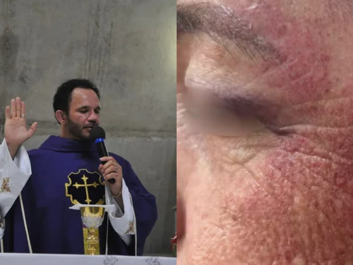 Padre é acusado de agredir idosa durante exorcismo em SP 1 padre e acusado de agredir idosa durante exorcismo em sp