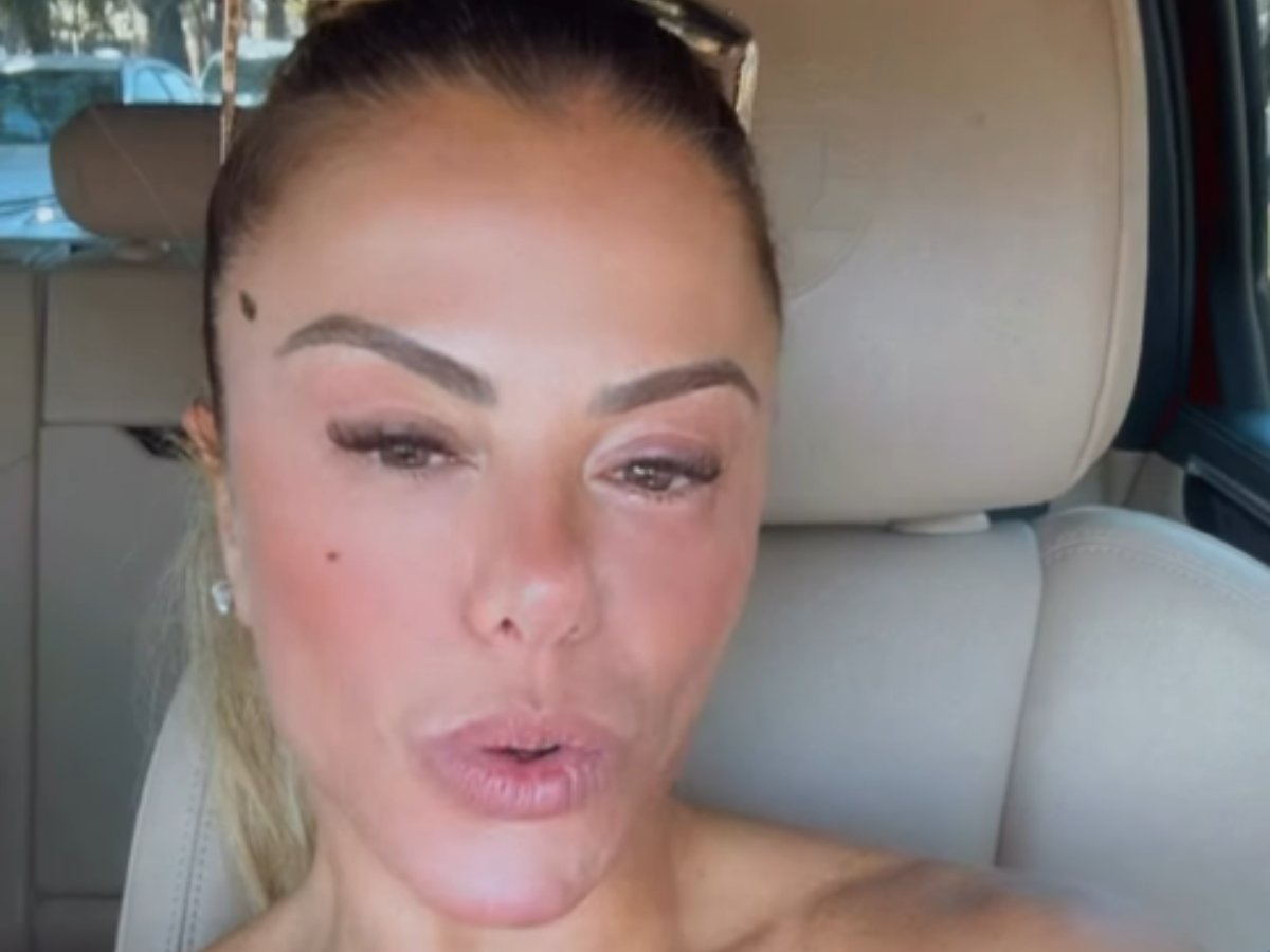 Poliana Rocha diagnosticada com conjuntivite química: Não é contagiosa 1 poliana rocha diagnosticada com conjuntivite quimica nao e contagiosa